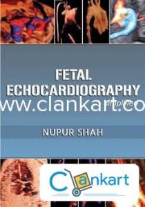 Fetal Echocardiography-simplified