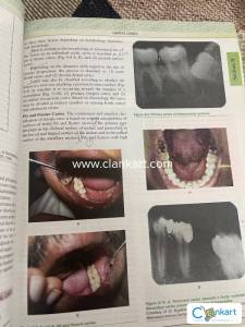 Oral pathology book
