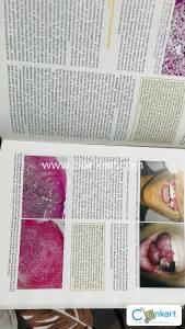Shafer's Textbook of Oral Pathology